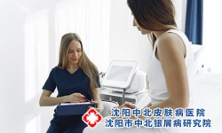 沈阳银屑病医院哪家治疗会比较好呢?