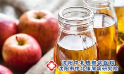 牛皮癣患者少吃酸性食品有助治疗 牛皮癣的饮食禁忌有哪些呢