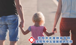 携带了银屑病的致病基因，一定会发病吗?沈阳银屑病医院，沈阳牛皮癣医院，沈阳皮肤病医院