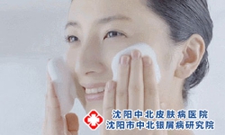 天气越来越热，银屑病怎么护理？
