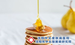 揭开银屑病饮食的秘密，沈阳银屑病医院