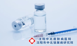 激素药物对银屑病患者的不良影响
