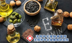 炎症会引起银屑病加重?饮食中“三含一抗”您要知道!