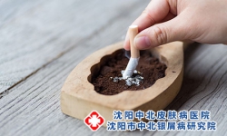 吸烟可增加患牛皮癣的风险?