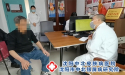 沈阳哪个治疗银屑病专科医院好
