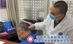 沈阳治疗牛皮癣医院：男性牛皮癣恢复率高不高
