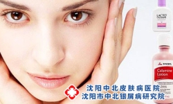 红皮型牛皮癣皮肤表面发红怎么办?