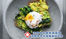牛皮癣患者可以吃鸡蛋吗?