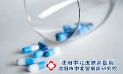 沈阳中北银屑病医院：牛皮癣科牛皮癣要怎样治疗