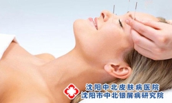 银屑病患者健康睡眠很重要，6个妙招帮你提升睡眠质量!