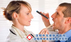 湿热型牛皮癣的症状表现有哪些?