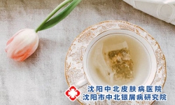 沈阳牛皮癣患者能喝的饮品