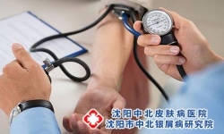 沈阳中北银屑病医院：点滴型银屑病其特点