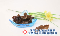 推荐几款适合银屑病患者的菜，快来看看