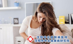 银屑病并发症可影响到多个系统或脏器，这几点要引起重视!