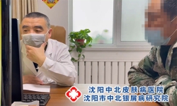 沈阳牛皮癣治疗医院春季预防牛皮癣方法