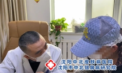 沈阳好的治疗银屑病的医院_总榜实时发布沈阳看银屑病哪里医院好