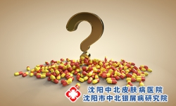 点滴状银屑病吃什么药好?