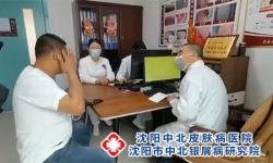 沈阳市牛皮癣医院排名榜公布沈阳中北牛皮癣医院排名