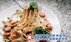 牛皮癣该注意怎样饮食-牛皮癣的注意事项有哪些呢？