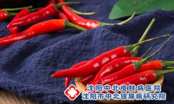 牛皮癣饮食千万别怕“热”