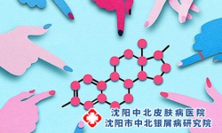 牛皮癣的临床分型有哪几种 常见的四种牛皮癣类型
