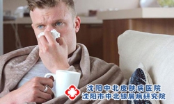 沈阳市银屑病医院在哪里男性银屑病容易治疗吗