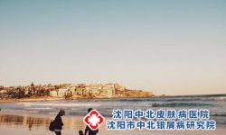 银屑病不断发展会威胁生命吗