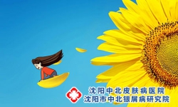 顽固牛皮癣为什么冬重夏轻?