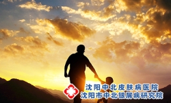 沈阳看银屑病：青少年疗银屑病的优势