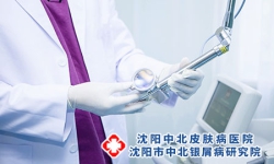 有哪些有效治疗牛皮癣的方法？