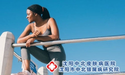 运动对促进银屑病恢复，真的很重要!