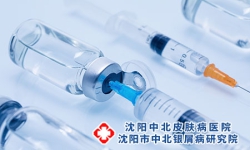 沈阳哪家医院治牛皮癣好 沈阳治牛皮癣专业医院