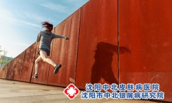 少年牛皮癣运动的好处是什么?
