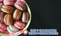 银屑病患者可以吃零食吗?