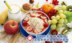 银屑病患者日常吃东西注意事项
