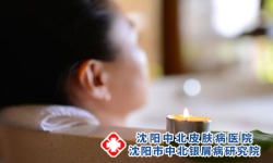 艾叶泡澡可以减轻银屑病吗