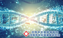银屑病的诱发因素都有哪些?