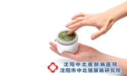 女性牛皮癣注意护理哪些方面