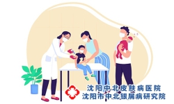 儿童银屑病常有什么特点?