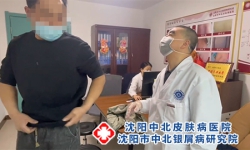 牛皮癣医院排行榜沈阳牛皮癣医院