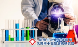 牛皮癣患者要注意避免高温工作环境