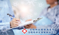 治疗牛皮癣的最好办法是什么