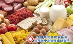 红皮病型牛皮癣在饮食方面注意什么?
