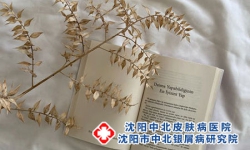 要想真正治愈牛皮癣必须做到三个阻断