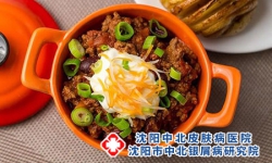 牛皮癣不能吃什么食物?