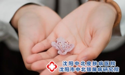 哪些因素会影响牛皮癣治疗