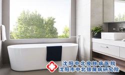 中医中药外洗治疗牛皮癣效果怎么样。