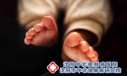 小孩会得牛皮癣吗？