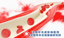 血燥症牛皮癣的护理应该怎么做？